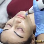 Rimi Sen Instagram - Treatment: Dermapen 4 Purpose: Dermapen 4 is nothing but Collagen induction therapy, 1. Promotes scarless healing and natural collagen reproduction 2. Tightening 3. Lifting 4. Rejuvenation of the skin. How it works: The Dermapen® is an automated micro- needling device, with a disposable tip cartridge, that uses 11 micro-needles to vertically stamp the skin at high speed. The stamping action of the Dermapen's vertical tip creates micro-injuries to the skin, stimulating new collagen production. Result: Dermapen 4 can offer incredible results, minimizing the appearance of acne, scar, wrinkles, pigmentation and so much more. • Significant reduction in the appearance of stretch marks and other skin blemishes. • Improves the appearance of ageing skin signs such as fine lines, crow's feet, and deep wrinkles. • Minimised pores for a smooth and flawless finish. • Faded hyperpigmentation such as melasma.