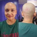 Lena Kumar Instagram – When my hair was shaved off we found proof of ‘The Matrix’  deprogramming plug in 😁. Check the scar on the back !! 
#The #Matrix #Neo #scar #throwback