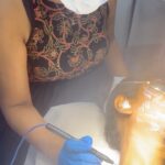Chinmayi Instagram - We had a client coming to us with an uncommon amount of DPNs, Skin tags and Warts. This is how we treated them! Radio frequency Ablation is a quick and effective procedure that precisely targets and heats the tissue and removes DPNs, Skin Tags and Warts. Want to address your skin concerns and get the best treatments? Book a consultation with our expert dermatologists today! For appointments 📞Chennai +91 7358320111 📞Hyderabad +91 9150598889 Visit: www.deepskindialogues.com #skinglow #skintags #skinrevival #chennai #hyderabad #deepskindialogues #skintreatment #skinlove