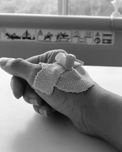 Pavani Reddy Instagram - So These 15 days of my life was so tough to spend. It just began with the small pain in the neck. And pain started increasing day by day. I consulted many orthopedist, started my physiotherapy but  the pain went unbearable. I started crying out of the pain spent many sleepless nights and In between I had even shoots to attend. Hook or crook I had to work. I dint had an Option to take a break . So I  chose to work, with this pain and flied to Hyderabad. the  people on my sets were very supportive made me feel  like home. and  that’s how I completed my shoot part. I continued  my physiotherapy everyday but the pain still went worse,  I could not lift my right hand felt like it was broken. early morning  waking up and getting ready was a big task for me. I would scream louder out of the pain. hit the wall feeling helpless. Getting ready for the shoots. and I finally ended up with this ( Endoscopic discectomy) surgery done by Dr Sukumar nd @asian.spine.hospital now feeling much better and out of the pain a big thanks to them. will be getting discharged today. 
In this  process not only me but my family nd my friends also suffered  a lot. thank u @amir__ads for being there in this pain I know I have disturbed your  sleep and  your work too. I know I just become a  cranky baby, when I am in pain.😬and that was so sweet of you and @niroopnandakumar  for driving all the way to Hyderabad to  surprise me love you both 😘
Thank u @anu_anushachowdary for always being there for me. I know that was a task for you to put me back to normal. I know I have troubled you too. thanks for taking my mood swings, anger, frustration 
thanks to my family my friends  who visited me and made me feel special
Love you all missed you all 
🫶