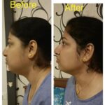 Gauri Pradhan Tejwani Instagram - Progress in 10 sessions. #OorjaByGauri #faceyoga #transformation #pranayama New face yoga batches starting from tomorrow, 12th of June