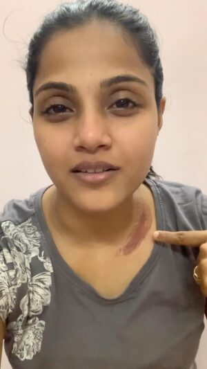Vaishali Thaniga Instagram - While travelling in car please wear seat belts it’s for our safety. I got escaped by minor accident is just because I was wearing seat belt and when the car got crashed air bag rescued me from major accident. Seat belt is must when you travel especially on highways.