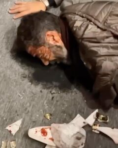 Abdel Aziz El Sayegh Instagram - هذا اللي صار فيني الله فوق كل ظالم