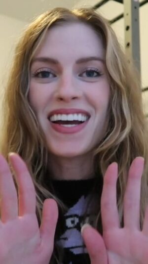 Barbara Dunkelman Instagram - Talking about my experience with this condition, and about the surgery I'll be getting this month! It's hard to explain just how much this has affected me socially, mentally, and physically over the last 20+ years, but I'm so excited for the results and to have dry hands for the first time. If you're someone who suffers from Hyperhidrosis, I feel you, and I am so sorry - because it ~fucking sucks~.