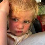 Ed Stafford Instagram - Molly took a tumble. And she resultantly looks like a Neanderthal. 🙏🏻🤣❤️🔥Absolutely love you Mols xxxx