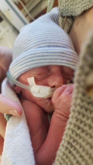 Elisabetta Fantone Instagram - First time I was allowed to hold my baby boy I felt an overwhelming rush of love and desire to protect him. I fantasized about wrapping him up and running out of the hospital to bring him home. I fantasized about somehow turning back time and changing the course of events. I felt I had lost all control. I felt my baby was being taken away from me. I felt utterly hopeless.
He was in such a rush that he decided to make his big arrival at 28 weeks weighting only 2.1 pounds. 

I lived such a beautiful pregnancy just like I did with my daughter that I felt like I was floating on a cloud. I've been blessed to breeze through it and thus I've deeply enjoyed being pregnant with both my children. Although this time around his birth was completely different. Such an unexpected turn of events. Something I never thought would happen and never thought I'd have the strength to get through. But I did. I have fought and conquered all the difficulties, struggles and fears that a #nicuparent has to experiance seeing their little baby fight for their life. The agony of being seperated from your baby for over 7 months.  Something I don't wish for any parent to go through because it is a brutal and lonely journey. But with suffering comes perseverance and endurance and endurance produces character. And somehow G/d answered our prayers and we make it to the other side. 

When I would be asked if I was expecting a boy or a girl I would often answer 'a fighter'. Little did I know I would birth a real warrior. The youngest human being I know with the strongest physical and psychological strength. 

#nicu #nicubabies #nicuparent #preemie #prematureawarness