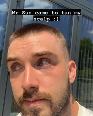 George Robinson Instagram - a tragedy in three parts