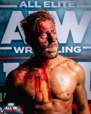 James Cipperly Instagram - I think I’m gonna use chopsticks for a while.
.
.
.
#baybee #Tuesday #aew #aewallin #wembleystadium #fork #aewstadiumstampede #blood #wrestling #fight #tired #noglasses #notfun #sotired #seriouslytired #photography #portrait

@beyondgorilla always takes the one
