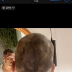 Jordan Haj Instagram - Ze 100% zarostlá ALOPECIE zítra 13:30 Q&A a livestream s Dr. Která mi to vyléčila. O léčbě co jsem absolvoval já, o tom jestli je to jistota, když to zkusíš léčit stejně, a o dalších možnostech léčby. Už delší dobu mi denodenně chodí dotazy na téma alopecie a já se snažím odpovídat svemdomitě ale vlastně na většinu otázek eridované odpovědi samozřejmě nemám. Budu zítra (neboli dnes, v pondělí 19.6.) Na kontrole u paní doktorkorky @monika_arenbergerova ve vinohradské nemocnici a poprosil jsem ji, jestli by se mnou neudělala livestream ke kterému by se mohli připojit ti, co mi píší dotazy a dostat odpovědi připmo od ní. zkusím to tu pak uložit s co nejobsáhlejším pokrytím toho jak jsem to k současnému úspěchu(snad na co nejdéle trvajícímu) absolvoval pod jejím dozorem a péčí já.