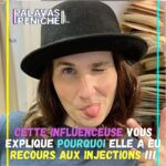 Joséphine Draï Instagram - Et vous, avez-vous déjà eu recours à des injections d’acide hyaluronique illégales ?