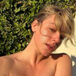 Lili Reinhart Instagram - Since I was 12, I’ve struggled with acne. My skin has suffered consistent breakouts, hyperpigmentation, redness and scarring. I feel impassioned and motivated to find solutions for not only myself, but others who struggle as well. This is my skin now, makeup free… no filter. I can’t wait to share more about what I’ve been working on 🧚🏻‍♂️