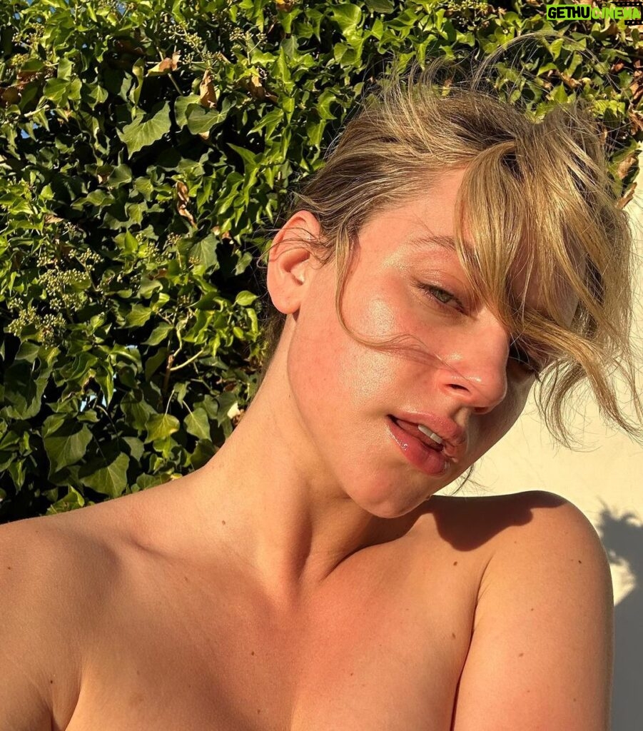 Lili Reinhart Instagram - Since I was 12, I’ve struggled with acne. My skin has suffered consistent breakouts, hyperpigmentation, redness and scarring. I feel impassioned and motivated to find solutions for not only myself, but others who struggle as well. This is my skin now, makeup free… no filter. I can’t wait to share more about what I’ve been working on 🧚🏻‍♂️