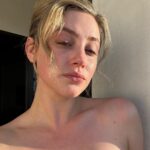 Lili Reinhart Instagram – Since I was 12, I’ve struggled with acne. My skin has suffered consistent breakouts, hyperpigmentation, redness and scarring. I feel impassioned and motivated to find solutions for not only myself, but others who struggle as well. This is my skin now, makeup free… no filter. I can’t wait to share more about what I’ve been working on 🧚🏻‍♂️