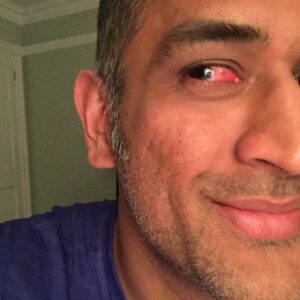 Mahendra Singh Dhoni Instagram - That's what happens when u get hit by bails,lucky only had to keep wkts with blurred vision and pain