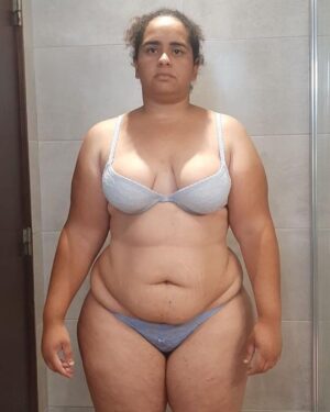 Manuel Pinto Coelho Instagram - Veja a incrível transformação do antes e depois da nossa querida Miriam! Menos 53kg num processo de emagrecimento sem remédios ou cirurgias plásticas @_miriampessoa_ 

👉 Procure-nos e marque a sua consulta através do contacto (+351) 211 359 070 ou através do site www.doutorpintocoelho.pt