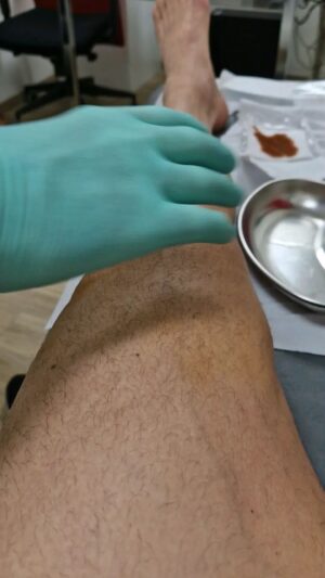 Zlatan Ibrahimović Instagram - Emptied the knee once a week for six months