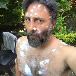 Aziz Kedi Instagram - su çiçeğiyim. kulağa bir volkan konak şarkısı gibi gelse de hayır, bildiğin chickenpox. sağlık ve sıhhatle kalın.