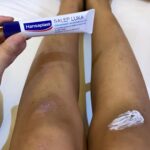 Brisia Jodie Instagram - Kemarin aku sempat jatuh, kalian pasti udah tau kan? rasanya tuh sakit, puyeng dan perih-perih gitu. Tapi Sekarang udah lebih baik Aku rutin ngerawat luka pakai Hansaplast Spray Antiseptik yang ajaib banget, ga perih buat bersihin luka. Kata dokter, luka harus dibersihin pakai antiseptik luka yang aman untuk bunuh bakteri biar ga infeksi, jangan pakai alkohol ya karena bisa merusak jaringan kulit yang sehat! Hansaplast Spray Antiseptik ini kandungannya aman banget ada kombinasi Decyl Glucoside Tenside dan PHMB yang dilarutkan bersama Ringer Laktat (cairan infus). Setelah bersih, dokter bilang luka mesti dilindungi dari bakteri pakai plester. Aku baru tau sekarang Hansaplast punya plester ukuran besar, bahkan ada kasa sterilnya juga dan salep luka yang bisa menimalisir bekas luka baru. Sekarang aku mau cobain salep lukanya @hansaplast_id. Udah ada yang pernah coba belum? #appreciationpost Seneng Bgt Bwt Hari Nie My Best Prend