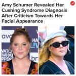 Buzzfeed Instagram - "Aside from fears about my health, I also had to be on camera having the internet chime in." More at the link in our bio 👆