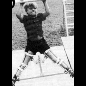 Cameron Mathison Instagram - In honor or Rare Disease Day I’m posting about the rare degenerative bone disease I had as child: 
Legg Calve Perthes Disease.
I was diagnosed at two years old and wore this leg brace night and day for 4 years to allow my femur bones to harden and support my body. 
The treatment has come a long way since then, but still so much to learn about this rare disease.
@leggcalveperthes and @pertheskids are two great organizations to support and  to learn more🙏🏼
#rarediseaseday 
#rarediseaseawareness 
#leggcalveperthes