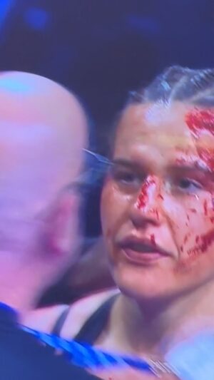 Chantelle Cameron Instagram - She’s a FXCKING warrior 🔥

@chancam91 Cameron put on one of the BEST fights I have ever seen 

Absolutely FXCKING amazing and by far more entertaining than men’s boxing recently

This girl has pure heart ❤️ you did yourself FXCKING proud, go back for FIGHT 3 🔥🔥 I got you!! 

FOLLOW her @chancam91 see for yourself 🙌

#boxing #aarronlambo #chantellecameron #mental #supplements #gym #fitnesss