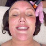 Charlotte Crosby Instagram - I only trust the best with my skin @jsmithaesthetics @facialsbylauren_jsa