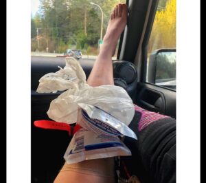 Chelsey Reist Instagram - attempting to jump a four foot gravel road skiing down a mountain at max speed sometimes ends with tiny doggies, tensors and tequila. 
it also sometimes ends in the middle splits with your body somersaulting through your legs...so i hear 😂

i definitely support safe skiing and i also support taking risks; genuinely feel pumped and proud of myself for attempting this trick with gusto. looking forward to icing this down quickly, would be a win to land it before the #skiseason is over. (check out our janky tensor job with a ski strap😂) #adrenalinerush #reistmode #beastmode #nomakeup #nocares and thanks to the fan who bought me this dope toque— told ya i couldn’t wait to wear it!
#whistlerdreamgetaway