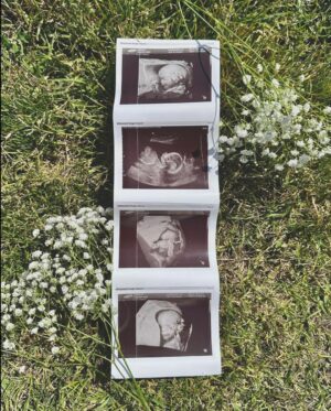 Emmy Buckner Instagram - One last photo dump and a big thank you to everyone who has reached out, messaged, commented, anything! We are feeling the love and it really means a lot as we buckle up for our biggest adventure yet ❤️

📸 @adwinbrown