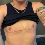 Gabe Dunn Instagram - Changes: moved to West Hollywood, had top surgery (photo is like a month post op), changed my name (dad approved), went on T shots, sold a TV show, @allisonraskin had a Bachelorette party, I wrote and am directing my debut feature film, Allison got married, movie entered pre-production. Who else had quite a year??