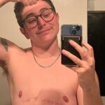 Gabe Dunn Instagram - Happy no-tit a versary to me! My chest is one year older one year wiser. If you wanna get me a gift, donate 1 dollar to my trans love story movie at the links in my bio! I am serious! And if you have any top surgery questions, I’m an open book. Also thank god for squeeze applesauce packets.
