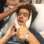 Gaten Matarazzo Instagram – Though my expression in this picture may not show it, the surgery was a complete success😂. This was such A big one, it may be the last one I need. Hopefully at least. Those who suffer from Cleidocranial Dysplasia usually have Supernumerary teeth, which are extra teeth that grow in the gums. I’ve had several surgeries to extract these teeth from within my gums and help expose the teeth that should have already grown in considering my age. In this surgery, the team of amazing medical professionals extracted 14 supernumerary teeth and exposed six of my adult teeth. I was under for four hours. My recovery for the past few days has been great and I can’t thank the team that did the surgery enough. Thank you all for your kind wishes and prayers. It means a lot. Again, if you’d like to learn more about Cleidocranial Dysplasia, you can go to ccdsmiles.org. Thanks again everyone