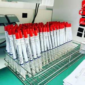 Hendrik Streeck Instagram - Last SARSCoV2 screening run for today... It’s not getting boring! Big thanks to the team!🙏🏻 #covid_19 #coronavirus