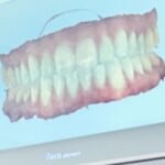 Hunter March Instagram - ✨ this holiday season I’m selling full replicas of my mouth so that you too can experience the joy of having too many teeth ✨