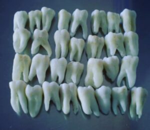 Jennifer Robertson Instagram - Am I a bad bad parent because I have ZERO desire to save my child’s baby teeth? If I save them and give them to her as an adult what is SHE supposed to do? Give them to her children? I feel like the long game is giant mason jars of “Family Teeth” and the thought makes me wanna barf a little bit.