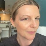 Jennifer Robertson Instagram - A lot of you have been asking for an “eye update” so…first pic is today, second pic is a day after I tried to water a hanging plant. It’s healed nicely thanks to a brilliant and kind plastic surgeon who re-did my ER stitches less than 24 hours after my fall. ALSO apparently there is challenge this week to post unfiltered pictures of yourself so both of these are unfiltered like a menthol.