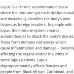 Jess Impiazzi Instagram – A lot has been going on here since the start of the year!… I don’t know where to begin!
Obviously I was very open with the IVF journey and the process, but during that time and pretty much since early January I had been getting sicker and sicker, this was with inflammation, stomach issues that were debilitating. As the months rolled on I’d have muscle spasms, my joints would swell and I’d be unable to move my entire body, my eyesight got worse, the fatigue was something and is still something I’ve never experienced before. From being in the gym nearly everyday and running 5k’s this has just been horrid. Then I got rashes all over my chest arms and face (I’ve learnt how to cover them well with make up, but without it it’s horrible down my nose and my whole forehead)
In July I had three trips to A&E from the pain, I just knew I was getting worse and I was really struggling! Mentally it’s taken a toll, if the IVF and that failing wasn’t hard enough this was topping it off! 
After many, many tests and lots of blood taken I was diagnosed with a chronic autoimmune disease called Lupus. (Swipe along to see more info on lupus taken from @lupus_uk) I am currently on steroids to get this under control and then see what the future holds medication wise but having a diagnosis helps as I can now work with the doctors to get myself living again and do whatever it takes to keep my body in the best working condition! 
I’ve had amazing friends and family supporting me! (You know who you are!) I’m looking in to something’s as to why it’s happened and what may have caused it although it’s hard for doctors to establish that, however I did have an operation late December  last year that I feel may be linked. (I’ll talk about this in detail once I know more) 
If anyone has autoimmune issues especially lupus please reach out and let me know ways that may have helped you! 
Anyways… that’s what’s been going on lately and have felt a little bit lost but I’m finding my feet again! I’ll bounce back with tweaks and get the show back on the road! 🌈🦋💖 peace and love to everyone 💖🎀🦋 a thank you to @susehilly for helping me tell my story in todays paper 💖.
#lupus #autoimmune #ivf