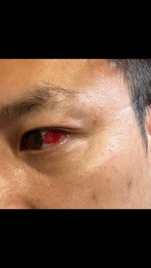 Justin Cheung Instagram - 明知係「沙包」，都係要去試吓，去面對。

我分享俾大家面對強大嘅對手，唔好縮，唔好避。

一字記之曰：「矛」😂

起碼都叫打中過吖⋯

細孖 @uncle___p ，等我落埋磅收亁埋個身，我會攞齊架生搵你，等我😘

@jason_583 @wdt_fightgear 

#左眼都俾你打爆埋
#sparring係好好玩好有用
#摺凳是必需要的