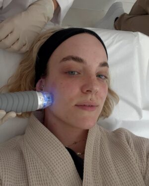 Kateřina Mlejnková Instagram - 1.-2. Microneedling at @aramedicalecce (Omg pak ta nádherná zářivá pleť 🤤)
3.-4. Top jídlo
5. Kostel 
6. Vitamíny pod oči, které jsou skvělé na vrásky 
7. Yoga time 🙏🏼🫶🏼