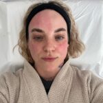 Kateřina Mlejnková Instagram - 1.-2. Microneedling at @aramedicalecce (Omg pak ta nádherná zářivá pleť 🤤) 3.-4. Top jídlo 5. Kostel 6. Vitamíny pod oči, které jsou skvělé na vrásky 7. Yoga time 🙏🏼🫶🏼 Lecce, Italy