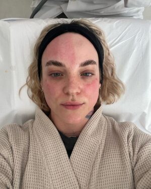 Kateřina Mlejnková Instagram - 1.-2. Microneedling at @aramedicalecce (Omg pak ta nádherná zářivá pleť 🤤)
3.-4. Top jídlo
5. Kostel 
6. Vitamíny pod oči, které jsou skvělé na vrásky 
7. Yoga time 🙏🏼🫶🏼