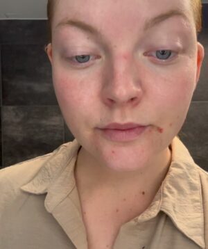 Lea Skálová Instagram - SOUTĚŽ UKONČENA 
PRVNÍ SOUTĚŽ  O ZELENÝ ZÁZRAK!
Ou jeeee, kdo mě sleduje dýl tak už ví, co si na ten xicht patlám. Kdo netuší o čem tady rapuju tak se koukne na druhý slide 😱😱😱😱❤️🚀🔥 Tahle věc je vhodná pro úplně všechny typy pleti a to i na ty super suchý a problematický. Neuvěřitelné kryje, hydratuje a má dokonce SPF50, takže nemusíš používat už nic víc ani make-up ani nic!!! A kdo to ví tak přesně pro něj je tahle soutěž. 
Pošli mi do zprávy svoji recenzi na tenhle produkt, stačí text, ale klidně přidej fotku nebo video ❤️❤️🙏 No a z doručených recenzí vyberu hned 5 výherců, který dostanou 5v1 zdrama ❤️😱😱 Tak spouštíme tohle šílenství 😂😂😂 
A od 23.8. se můžete těšit opět na slevu na cely e-shop. 

#soutez #recenze #zazrak #zelenyzazrak #skin #skincare #spf
@sortedskin_czsk @revolutionhairoficial