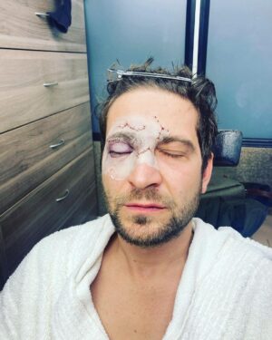 Marek Němec Instagram - Tohle byl dreamjob. Krásný,bolavý,smysluplný natáčení s @savel.soukup ! Těším se na výsledek jak vix! #annaismissing