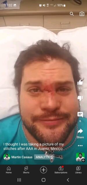 Martin Casaus Instagram - You wanna know how I got these scars??? A souvenir from Mexico from my late friend LA Parka. RIP amigo. Sometimes you just want to be a bull and maime some people

#MartinCasaus #McVenture #martythemoth #ProWrestling #wrestlingcommunity #ProWrestling #Mcfitness #Health #Wellness #Fitness #Healthy #Workout #SaltLakeCity #SLC #VisitSaltLake #Utah #SaltLake #UtahGram #UtahTravel #SLCCreativeCommunity #SLCContentCreators #utahcontentcreator #luchalibre #mexico #luchalibreaaa