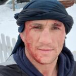 Merab Dvalishvili Instagram - In Georgia we have an expression ... It is better to break your head than break your reputation. 4 years ago, unfortunately I did both 🤣🤦‍♂️! But I am not ashamed .. I still laugh at myself. Warning: #donottrythisathome
