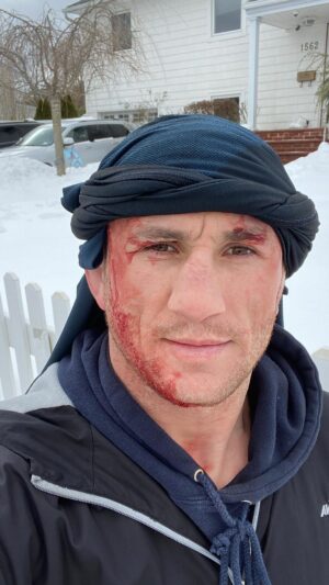 Merab Dvalishvili Instagram - In Georgia we have an expression ... It is better to break your head than break your reputation. 4 years ago, unfortunately I did both 🤣🤦‍♂️! But I am
not ashamed .. I still laugh at myself. Warning: #donottrythisathome