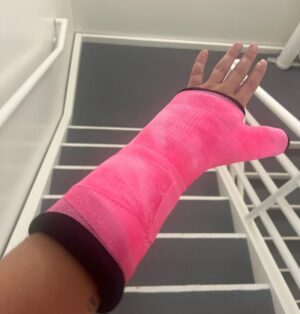 Mitra Jouhari Instagram - I have been in such a bad mood the past… year… so I’m posting something that made me feel so positive and happy today. Swipe to the final slide to see my amazing tits finally revealed!! Jk I fractured my wrist but it’s fine I am literally being so positive.