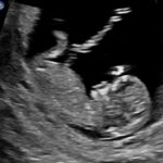 Riley Elliott Instagram - I’m going to be a dad! So stoked to have got to a point in this journey where Amber and I feel confident enough to share our joy, because the biggest thing learnt so far, has been the realities behind trying. I feel like I have a new found sensitivity, likely in part to aid in becoming a father but also because I have felt so powerless in the hurdles my incredible wife has overcome. Miscarriages are things I had never heard much about, but when you are unlucky and experience them, you realise you are not alone and in fact so many friends have run the same road at times. For those who haven’t had to, I do not mean to take anything away from your experiences, I imagine and will likely see that creating a human that then entirely depends on you is hard enough. This will hopefully be our next chapter. But up to this point all I can say is that women are so incredibly strong, so driven, and so capable. It’s really hard when you as a guy feel like the car driving alongside the railway tracks and it’s starting to sway. What I’ve learned so far is all you can do is be a rock of support and tell them that everything will be alright. Seeing tears rush from my wife at our half way scan, being happy tears, made the journey all worth it. To all those mums and ones to be, you are amazing. None of us would be here without you. To all those dads, I can’t wait for dad group chat lol. My next big task before the baby comes is to figure out how I juggle my existing 6year old wolf who never likes sharing the back seat!