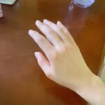 Sasha Clements Instagram - It’s easy to forget our progress! I documented my entire flare up just so I'd have references to look back on and i’m so happy I did! I couldn’t fit this ring on for almost a year (I tried every day). ⁠ ⁠ This week has presented some tough challenges and even though my fingers are still sore and I can see where I’m still swollen, I’m beyond grateful for the reminder that there has been improvement!🙏🏼⁠ ⁠ A little background- I was diagnosed with RA over 10 years ago. Was treated with Methotrexate and went into “remission”. Meaning my swelling and severe pain went down but I never really got better. I was still achy & sore. Had major brain fog & exhaustion to the point Corbin made me test for narcolepsy. I was always dealing with inflammation/ infections. I was constantly breaking out into rashes and hives and would be on Prednisone multiple times a year. So I was in "remission" but I wasn’t thriving - I was surviving. ⁠ ⁠ When I flared up again I was once again diagnosed with RA - then Lupus - then they added Lyme. With more testing we found I had high levels of mercury & lead, high toxic exposure, activated EBV, major vitamin deficiencies, hormonal imbalances, and mitochondrial dysfunction. ⁠ ⁠ I’ve been on a few different meds all with their lovely side effects🙄 Some have helped but I didn’t want to repeat the same pattern of just putting this bandaid on the pain. So here are some other things that have helped immensely!⁠ ⁠ -Working with a functional medicine doctor & getting testing done though them. Finding a mentor to guide me. I eat ZERO processed food, sugar, gluten, dairy, legumes, nuts, caffeine. I cook all of my food at home. I’ve tried many diets - AIP, low salicylate, carnivore, paleo, vegan, pescatarian and I found the trick is to just create your own diet prescription- your body knows what it needs. I take a rainbow of supplements, upped my water intake, practice gratitude, meditation, food combining, hot & cold therapy (sauna & cold showers), fasting, breath work, stretching, exercise, juicing, a wind down routine, & get good sleep.⁠ ⁠ It's a lot and wasn't achieved overnight but each layer you add will only get you closer to healing ❤️⁠ ⁠