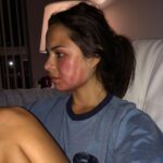 Sasha Clements Instagram - This is something I haven't shared and I'm a bit nervous to because my intention isn't to receive pity. I just want those who are going through the same thing to know they're not alone❤️ The last 14 months have been the hardest of my life. Every single day since April 23, 2020 I've been in physical pain with what doctors think to be an RA flare up. Some months were agony and some days were “manageable”.⁠ ⁠ When my joints first inflamed I thought it would be taken care of quickly. Little did I know I'd be forced to take a hard look at my life and change A LOT. I realized my symptoms had been going on for at least a decade with me just surviving through them. ⁠ ⁠ My pain & inflammation have been accompanied by a myriad of other symptoms. I’ve been through the wringer in terms of labs, appts, chemo drugs, severe muscle atrophy, chronic hives and weight fluctuations. I've unveiled a lot through testing and see how complex my issues are.⁠ ⁠ Chronic illness can't often be seen. I’d be told I “didn’t look sick” and that "it could be worse" but being in constant pain with no solution in sight is exhausting mentally, physically, and spiritually and I was often depleted in all 3 of these categories. ⁠ ⁠ Today I'm still in pain but it’s not as aggressive🙏🏼 I weaned off some meds that did their part but were making me feel awful. I've been on an eye-opening natural path. Every day I meditate, practice gratitude, eat intuitively, detox, supplement, use healthy ingredients, & put sleep first. I’ve worked on resetting my gut, negative habits & thoughts, and I don't allow myself to be in stressful situations if I can help it. I've also learned a lot about the flaws in how we've been taught to eat in North America. ⁠ ⁠ A positive that I've taken away from this is all of the life changing information & wisdom! I want to share this info and pay it forward as I continue to learn & share details of my journey. ⁠ ⁠ Thank you to everyone who checked on me and loved me as I grew through this. My angels who understood my experience and stepped in when I hit my rock bottoms. Corbin being my sturdiest rock of all. This has been my most grueling journey but somehow I'm grateful for it❤️ Los Angeles, California