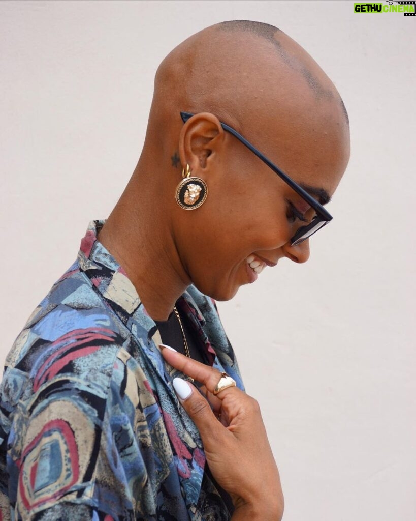 Sharon Battiste Instagram - alopecia | unrasiert | ungefiltert 🩵🩷 #alopeciaareata #kreisrunderhaarausfall #glatze